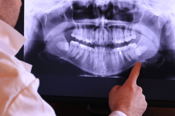 Best Emergency Treatment for Toothache in St Joseph, MO