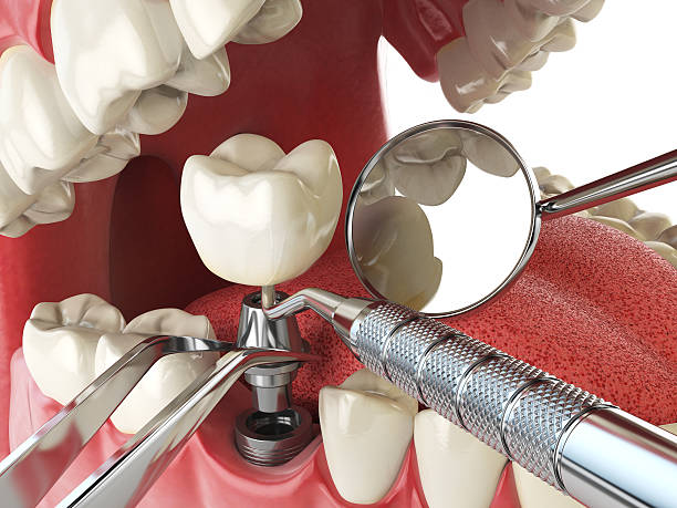 Best Weekend Emergency Dentist in St Joseph, MO